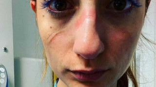 Συγκλονίζει Ελληνίδα αναισθησιολόγος του νοσοκομείου της Οξφόρδης