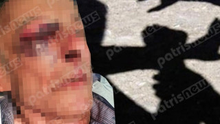 Άγριος ξυλοδαρμός 77χρονου από διαρρήκτες