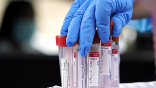 ΣΥΝΑΓΕΡΜΟΣ: 37 κρούσματα στη Θεσσαλονίκη, 23 στην Καβάλα