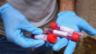 Πόσα κρούσματα κατέγραψαν σήμερα (2/8) Θεσσαλονίκη και Καβάλα