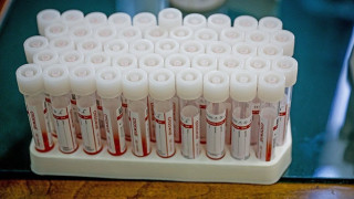 Ασλανίδης στο Metropolis 95.5: «Έκανα το ρωσικό εμβόλιο, δεν έχω κανένα πρόβλημα»