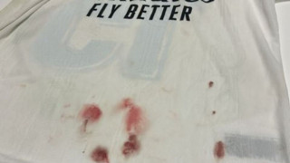 Η ματωμένη φανέλα του Βαλβέρδε και το σχόλιο της συντρόφου του