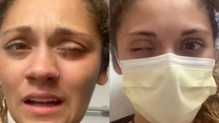 Απίστευτο: Μπέρδεψε το κολλύριο με κόλλα- Οι γιατροί τής έριξαν μαλακτικό στο μάτι για να ανοίξει