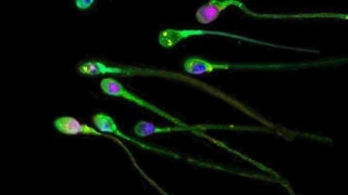 Υγεία: Σπέρμα και προσδόκιμο ζωής για τον άνδρα