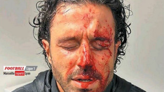 Το συγκλονιστικό πρωτοσέλιδο της Equipe με τον αιμόφυρτο Γκρόσο