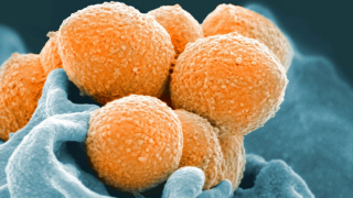 Στρεπτόκοκκος: Πώς μεταδίδεται και πώς μπορεί να σταματήσει