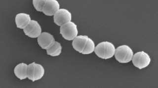 Ιαπωνία: Συναγερμός για έξαρση νέας ασθένειας