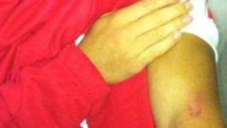 Ο Ιταλός... Σουάρες 