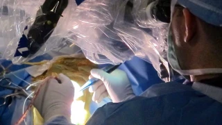 Καρκίνος εγκεφάλου: Νέα θεραπεία μείωσε θανατηφόρο όγκο κατά 50%