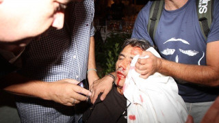 ΕΚΤΑΚΤΟ: Επίθεση κουκουλοφόρων και ξύλο στην κλήρωση της Φούτμπολ Λιγκ