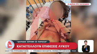 Χαλκιδική-Καταγγελία για επίθεση λύκου: «Δάγκωσε 5χρονη σε παραλία!»