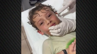 Ζωντανό καβούρι μπήκε στο αφτί 7χρονου!