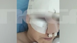 Σοκάρει η 45χρονη τραυματίας στο εμπορικό κέντρο: «Θα μπορούσα άνετα να μη ζω, το πρόσωπό μου έχει καταστραφεί»