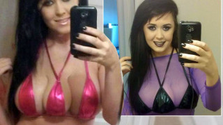 Γυναίκα  πλήρωσε 12,000 λίρες για να αποκτήσει τρίτο στήθος! (pic)